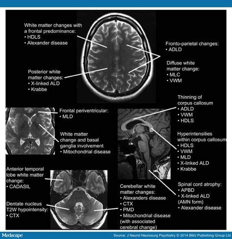 24 CNS RADIOLOGY ideas | radiology, cns, mri brain