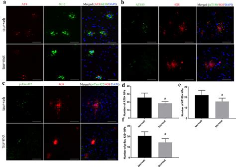 Metformin Reduced Np Tau Aggregation In Ps Be Injected App Ps Mice A