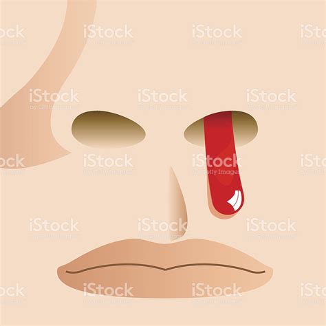 Nose bleed clipart 20 free Cliparts | Download images on Clipground 2024