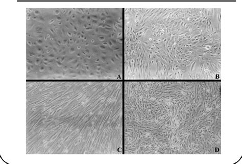 A Cobblestone Epithelium Like Cells In Cultures Of Scrapings Of The