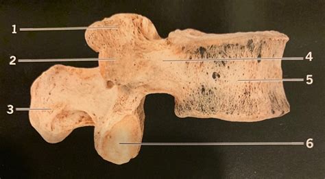 Lumbar Vertebra Lateral View Diagram Quizlet