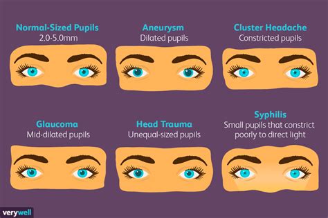 Pupil Size and Your Health