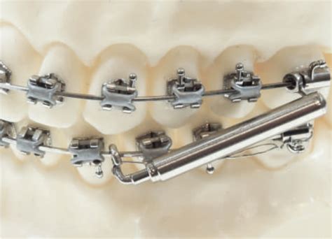 Vektorpro Class Ii Corrector Tp Orthodontics