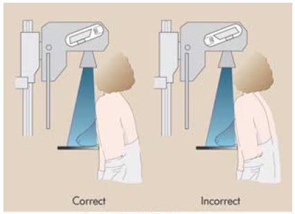 Mammography Flashcards Quizlet