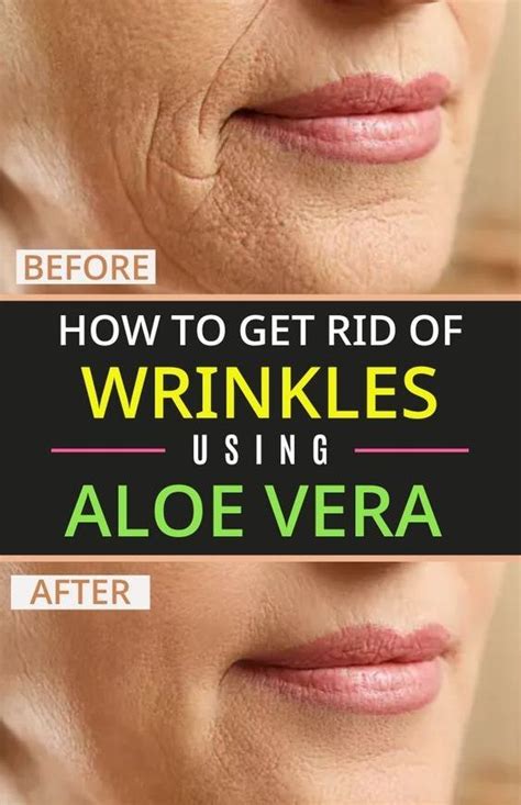 Get rid of skin wrinkles using aloe vera gel – Artofit