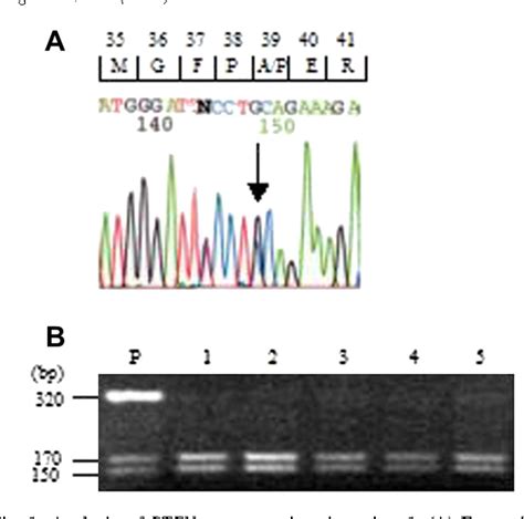 Figure 1 from A novel mutation of the PTEN gene in a Japanese patient with Cowden syndrome and ...