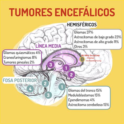 Tumores Cerebrales En La Infancia Neuronas En Crecimiento