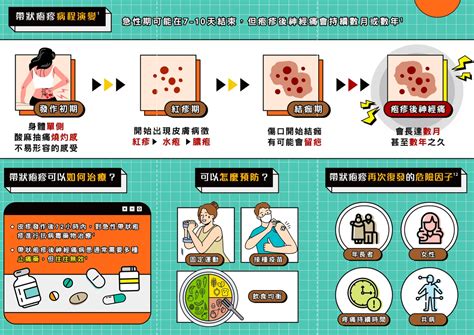 新型帶狀疱疹疫苗