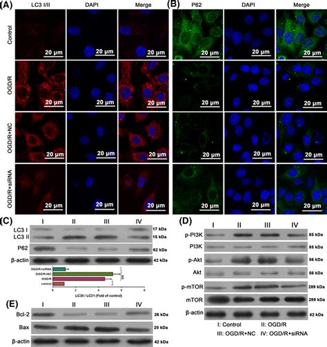 RMRP Knockdown Resulted In Activation Of OGD R Induced Autophagy And