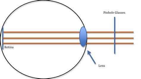 What Are Pinhole Glasses Natural Vision Hq