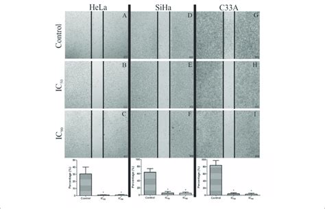 Analysis Of Cell Migration By Wound Healing Assay In Cervical Cancer