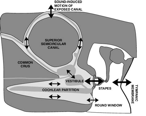 The Hypothetical Response Of Inner Ear Fluid Motion To Airconducted