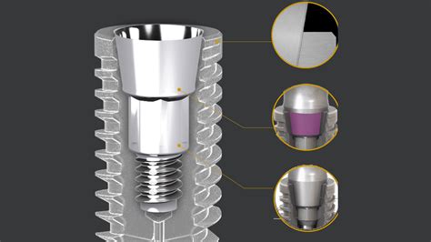 Triadontics Straumanngroup Neodent Implant Master Certification Program