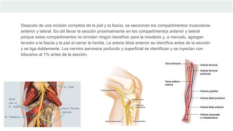 Amputaci N Transtibial Y De Tobillo Pptx