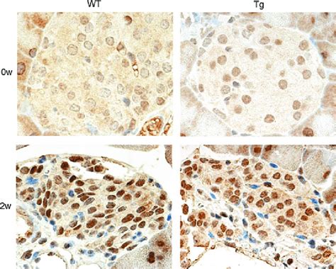 Immunohistochemical Expression Of 8 Ohdg In Wt And Tg Pancreas The Download Scientific Diagram