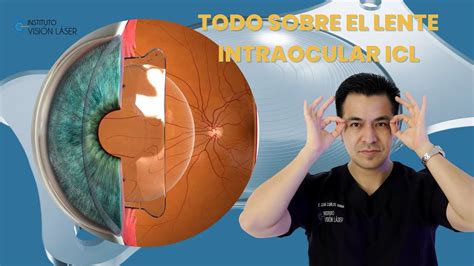 TODO SOBRE EL LENTE INTRAOCULAR ICL YouTube