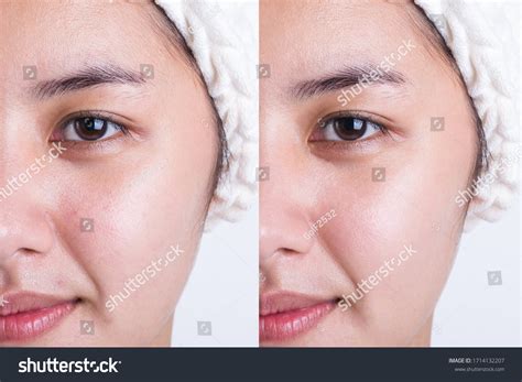 skin treatment   images stock  vectors