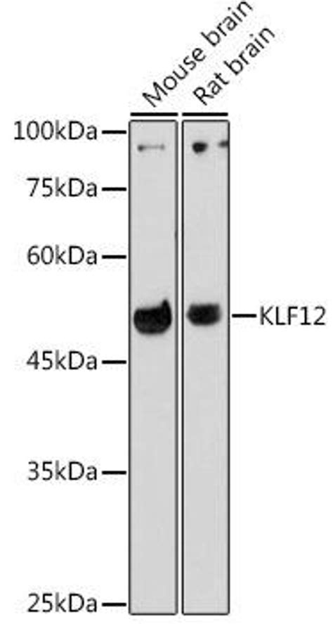 Anti Klf12 抗体 Assay Genie