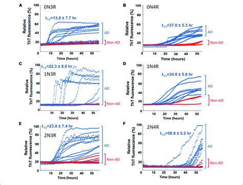 Real Time Quaking Induced Conversion Analyses RT QuIC Analysis Of