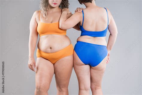 Two Overweight Women With Cellulitis Fat Flabby Bellies Legs Hands Hips And Buttocks On Gray