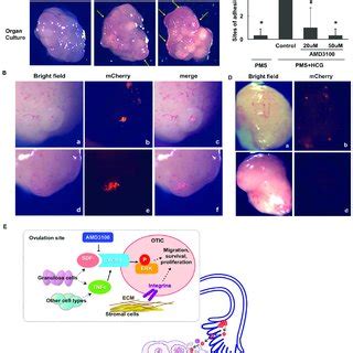 AF H E Staining Of Mouse Ovaries With Tumors Formed By OTICs