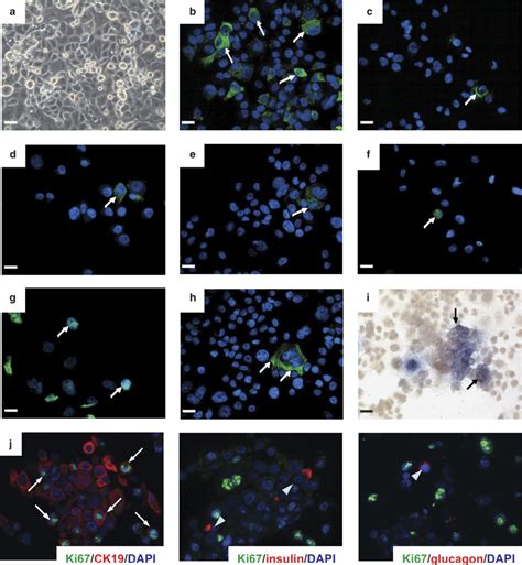 C Kit And Stem Cell Factor Regulate Panc 1 Cell Differentiation Into