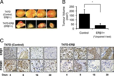 Expression Of Er1 Represses Tumor Growth And Foxm1 Expression In Nude