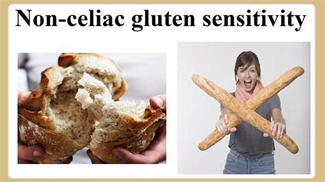 Non Celiac Gluten Sensitivity Youtube