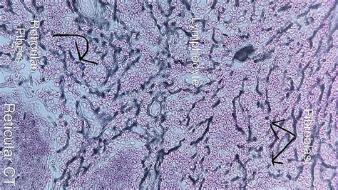 Reticular Connective Tissue Under Microscope Labeled Micropedia | My ...