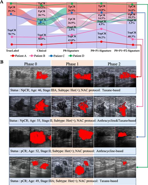 Visualization And Interpretability Of SUAS A The Sankey Diagram Of