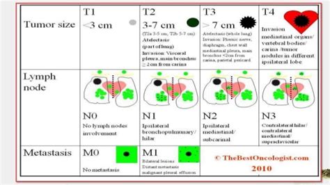 Lung Cancer Staging Tnm