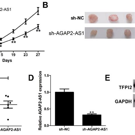 Silencing Of Agap2 As1 Suppresses Gbm Growth In Vivo U87mg Cells