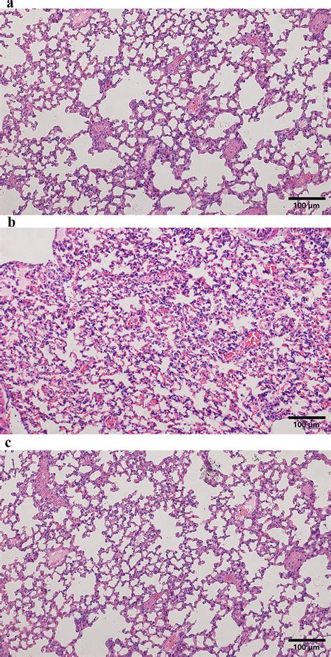 Representative Images Of H E Staining Of Lung Tissue In The Different