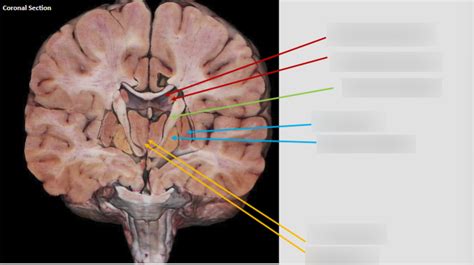 Coronal View of Basal Ganglia Diagram | Quizlet