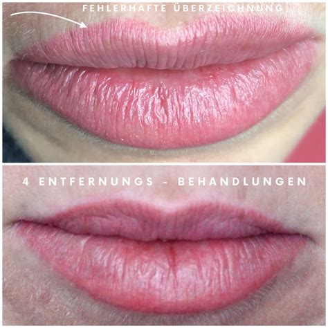 Permanent Make Up Entfernung Permanent Make Up M Nchen Preise Bei