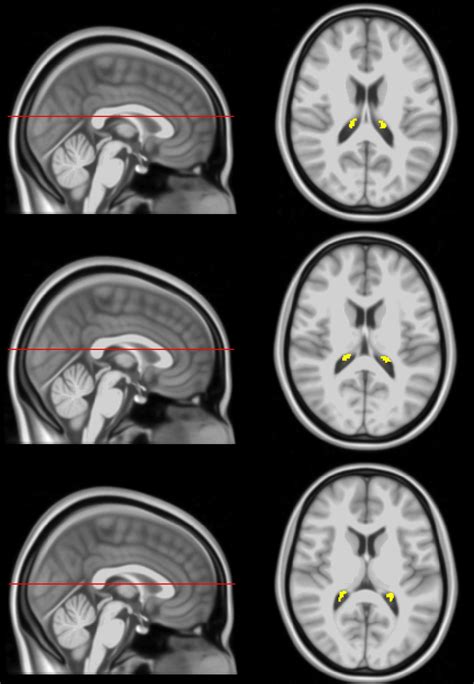 Frontiers Characterization Of Age Related Differences In The Human