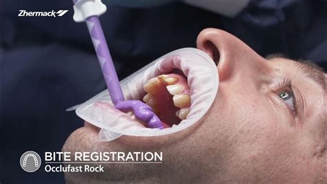 Dental Clinical Procedure For Single Unit Crown Chapter 2 Bite