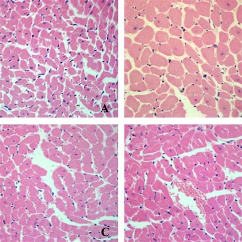 Effect Of Houttuynin On Cardiomyocyte Cross Section Area In Rats With