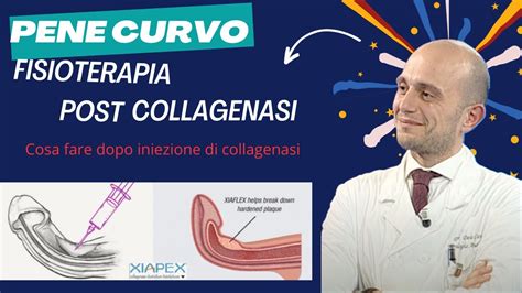 Cosa Fare Dopo Collagenasi Xiapex Per Malattia Di La Peyronie YouTube