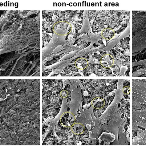 Pdf Effect Of Bovine Pericardial Extracellular Matrix Scaffold Niche On Seeded Human