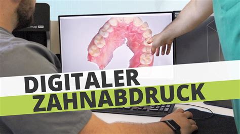 Video 02 Digitale Zahnmedizin Digitaler Zahnabdruck 360zahn