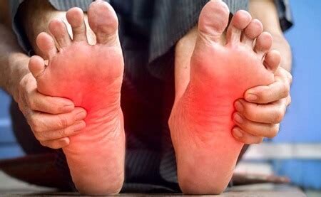 Hot Feet Causes Nhs