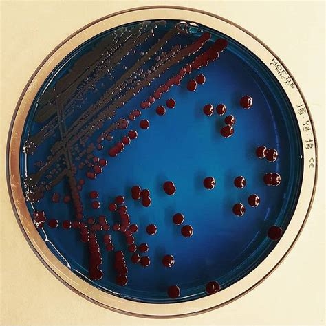 Serratia Marcescens On Lactose Agar Mikrobiyoloji Microbiology