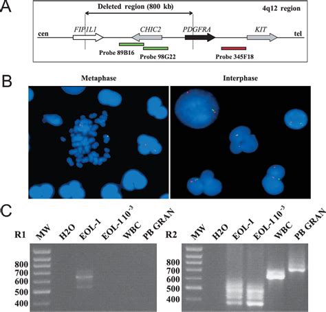 Pdf A Case Of Fip1l1 Pdgfra Positive Chronic Eosinophilic Leukemia