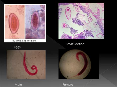 Ppt Enterobius Vermicularis Powerpoint Presentation Free Download Id413096