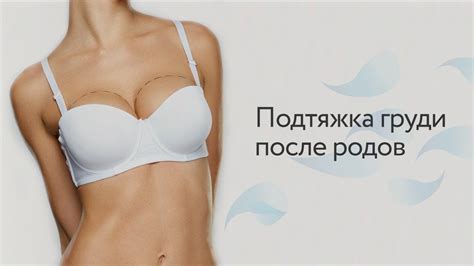 Подтяжка груди после родов - YouTube