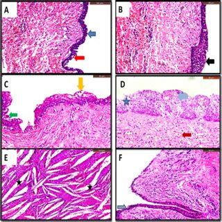 Photomicrographs Of H E Stained Sections A Showing A Cystic Cavity