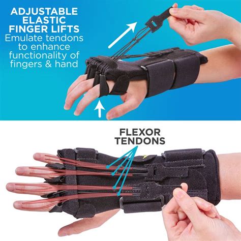 Radial Nerve Palsy Splint | Dynamic Wrist Drop & Finger Extension Brace for Saturday Night ...