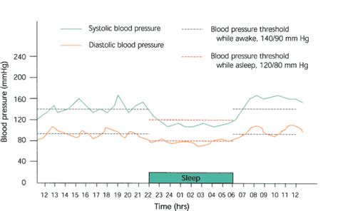 Automated Ambulatory Blood Pressure Monitoring Clinical Utility In The