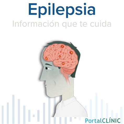 Crisis Epil Pticas Qu Tengo Que Hacer Epilepsia Podcast